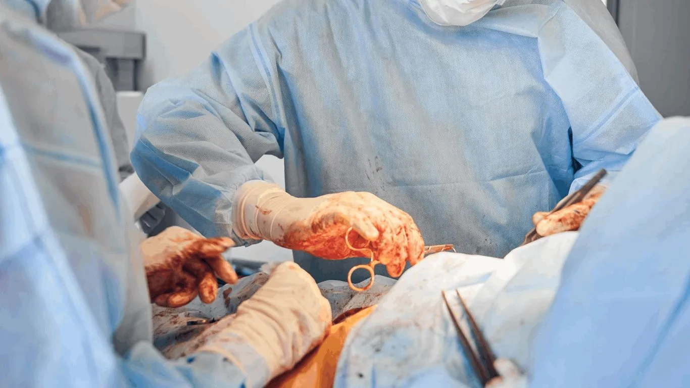 Ilustración — Miomas uterinos causas, síntomas y tratamientos