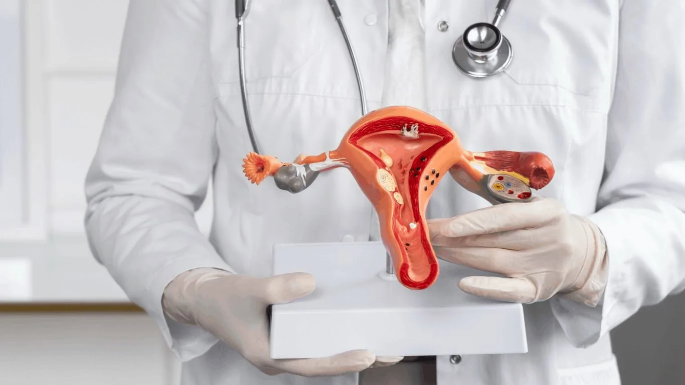 Quistes de ovario todo lo que tienes que saber