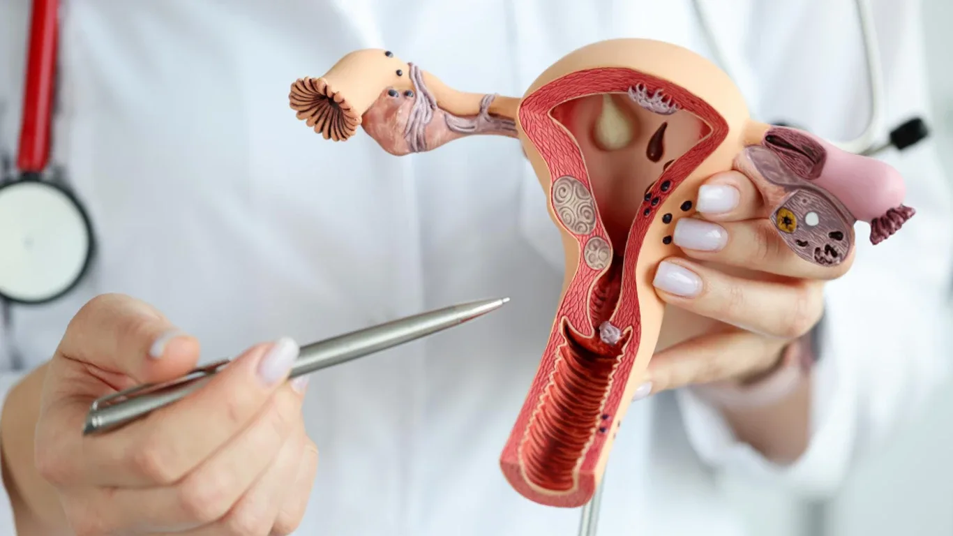 Ilustración — Quistes de ovario todo lo que tienes que saber