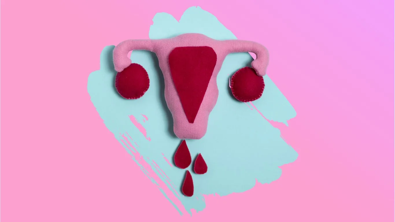 Ilustración — Menorragia comprendiendo el sangrado menstrual abundante y sus implicaciones